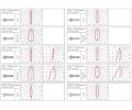 Светильник Lival Norm Single Extra